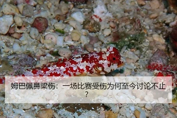 姆巴佩鼻梁伤：一场比赛受伤为何至今讨论不止？
